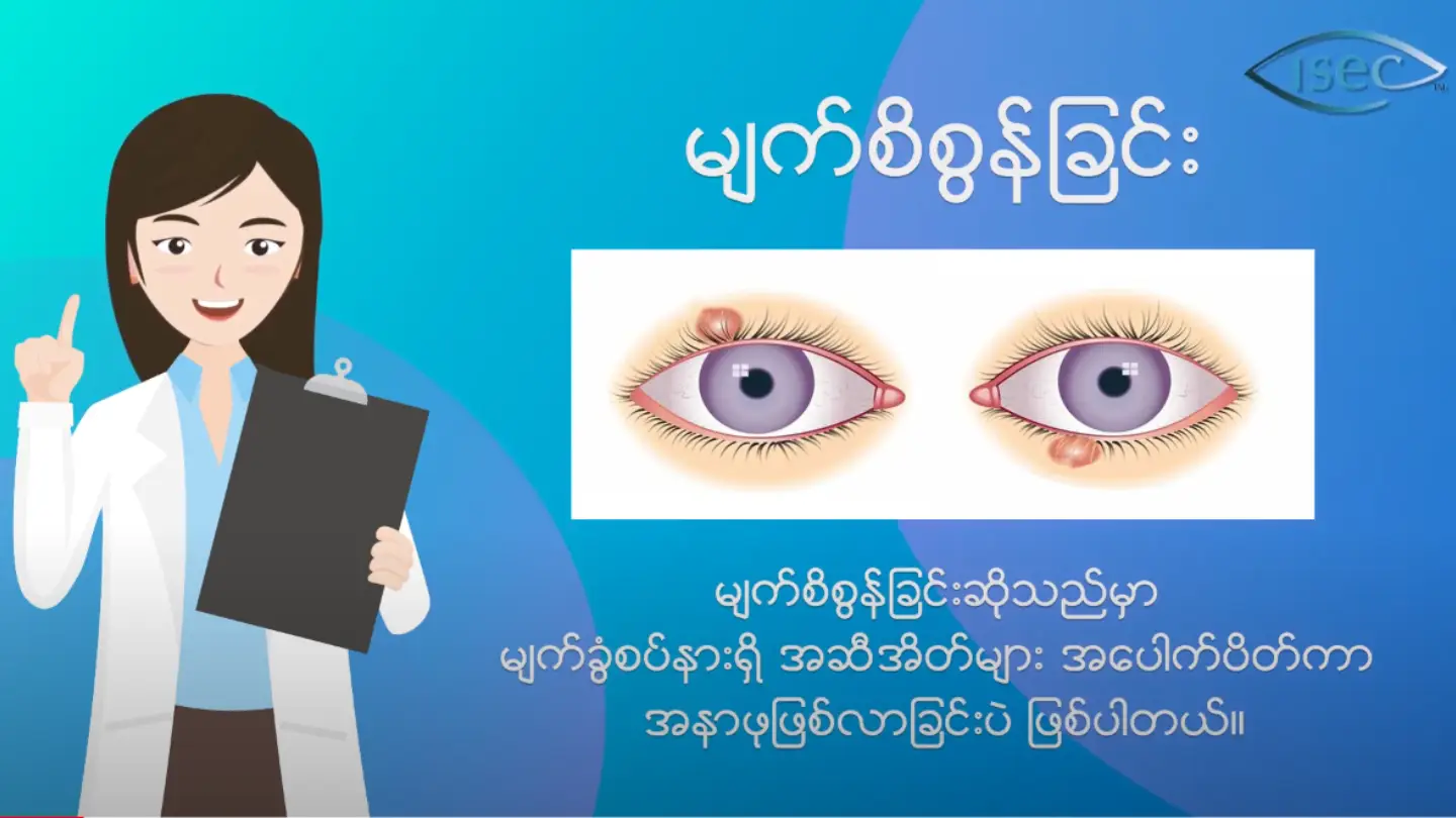 မျက်စိစွန်ရခြင်း အကြောင်း